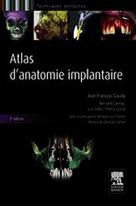 Download Atlas d'anatomie implantaire Ebook {EPUB} {PDF} FB2