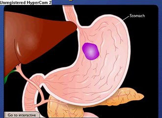 The digestion process - What happens to your food as it travels through your body until it exits?