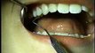Kirk Kimmerling DDS, Marietta Dentist Wants Proper Brushing & Flossing 770.423.4900