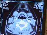 CT (Computed Tomography) Scan: What to expect