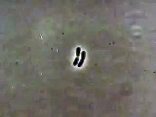 Understanding Bacteria Growth 🦠