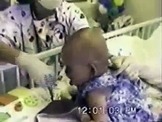 Pertussis