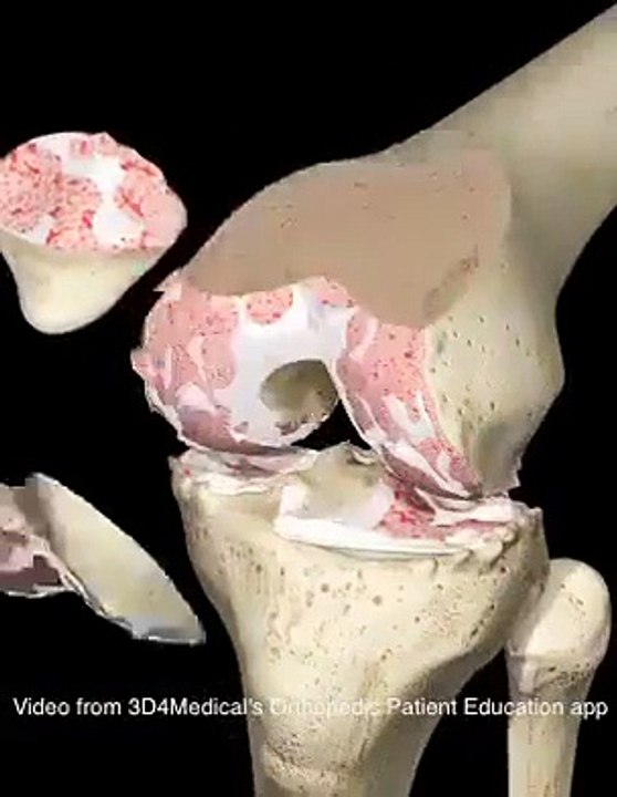 VID-20150329-WA0003.mp4
