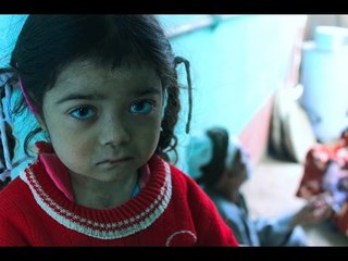 الطفلة نهلة تعاني من «تآكل الأطراف» ووالدها : «حالتنا المادية متسمحش نعالجها»