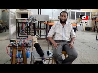 طلاب يخترعون «ذراعا الكترونيا» لمواجهة مرض ضمور العضلات