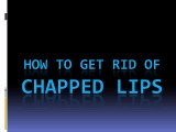 How To Get Rid Of Chapped Lips