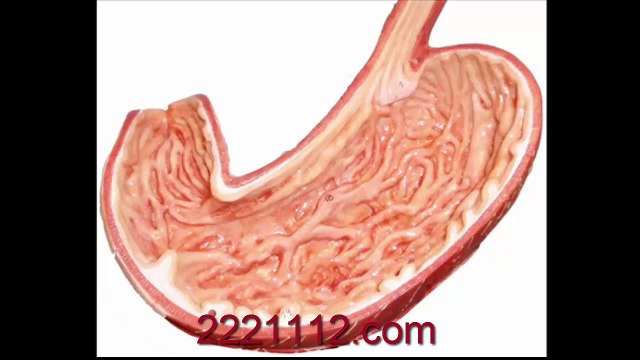 STOMACH_ PEPTIC ULCER -اردو