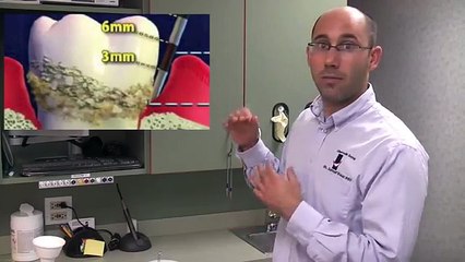 How to use a Waterpik to help Stop GUM DISEASE at home w/ Libertyville IL Dentist Dr. Sam Weisz