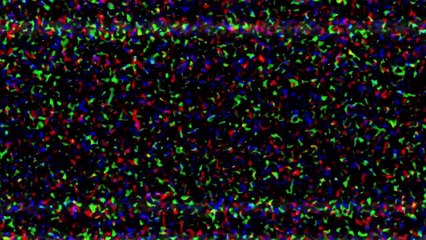 Welcome to Me Official Trailer #1 (2015) - Kristen Wiig, James Marsden Movie HD - dailymotion