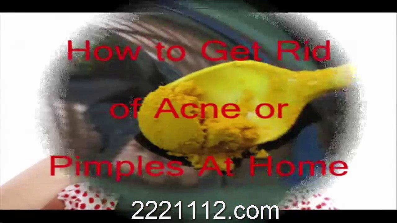 remove acne-pimple- 2