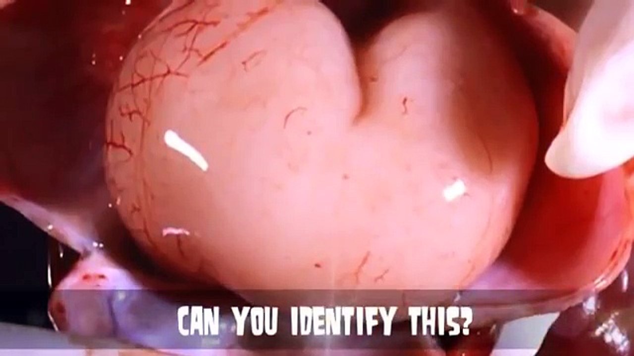 Mystery Diagnosis; The Morgue s Best Kept Secrets