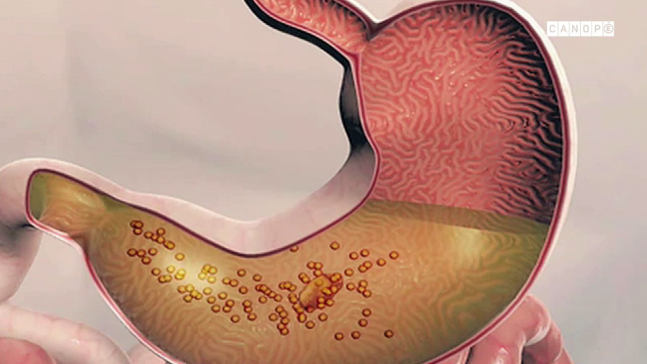 Digestion