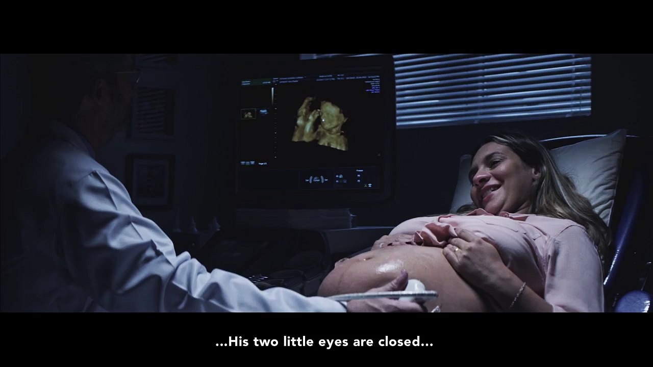 Elle découvre le visage de son futur bébé avec une échographie en 3D