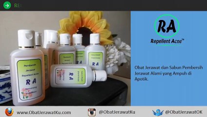 Ubat Jerawat paling Berkesan, Ubat Jerawat Mujarab, WA 085643699889