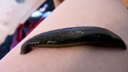Leech drinking my blood