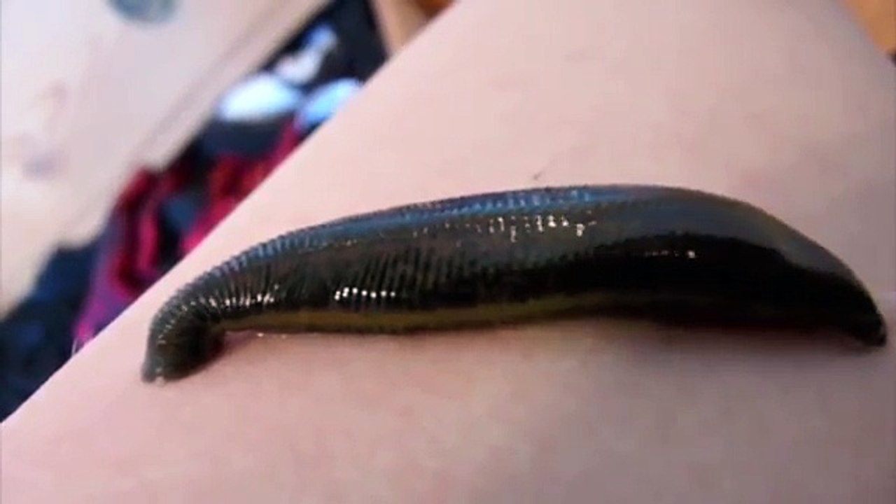 Leech drinking my blood