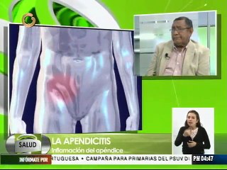 Download Video: Conozca las causas más frecuentes de la apendicitis