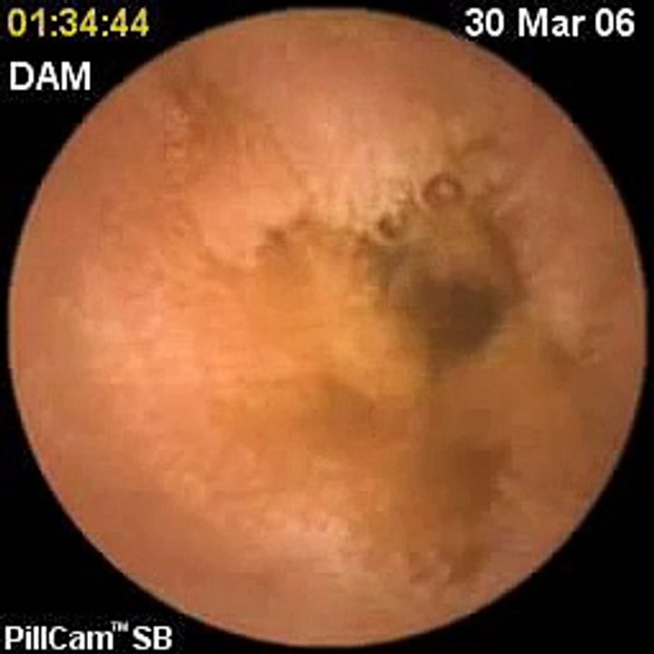 INSIDE THE HUMAN BODY