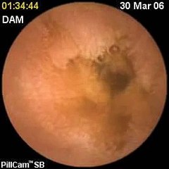 INSIDE THE HUMAN BODY