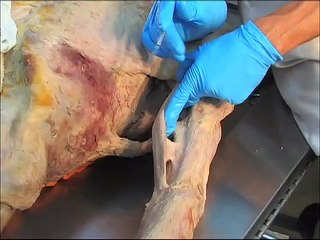 Gil Hedley: Fascia and stretching:  The Fuzz Speech