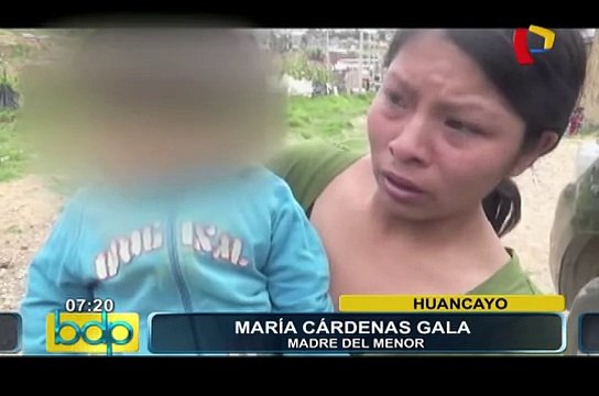Huancayo: niño de un año queda gravemente herido tras ser atacado por perro