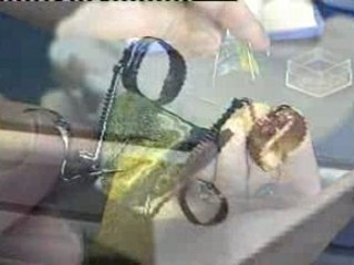 Understanding Distal Jet and Uprighter Jet Appliances 🦷