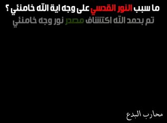 فضيحه سبب  النور الذى على وجه اية الله خامنئي