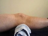 Knee Osteoarthritis Exercises - Inner Range Quads