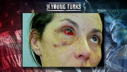 Woman's Face Shattered By Cop In Cell Following DUI [GRAPHIC VIDEO]