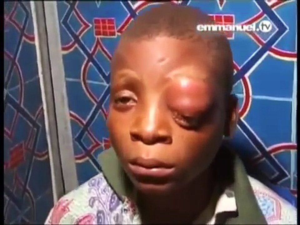 Watch This Eye OPEN After PRAYER!