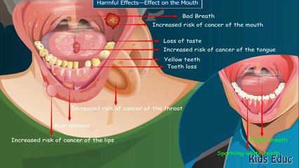 Harmful Effects Of Tobacco On The Human Body, Educational Video For Children