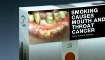 Mouth Cancer Anti-Smoking Ad