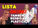 Top 6 famosos mais irreconhecíveis depois da plástica EVEEEEEEEEEEER
