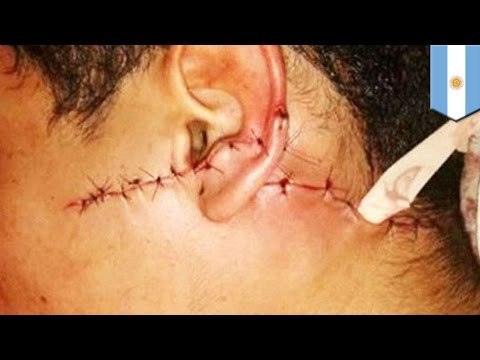 Argentino usa una espada samurái para defenderse y dejar gravemente heridos a tres ladrones armados