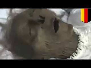 Real Life Zombie? Woman mistakenly pronounced dead wakes up inside her coffin