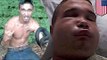 Deadly snake bites man trying to kiss it, venom almost kills him, leaves his face swollen
