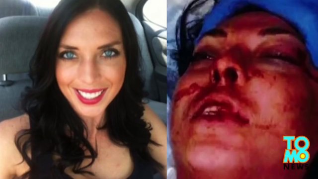 عارضة أزياء تحاكم شرطة المرور بعد أن قاموا ببطحها أرضاً متسببين بتحطيم وجهها