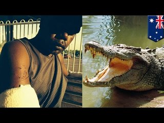 Croc attack fail: Australian man fights off croc with crazy eye gouge