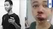 American teen Tariq Abu Khdeir brutally beaten by Israeli Police