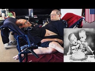 Senior citizen conjoined twins to set record as longest lived