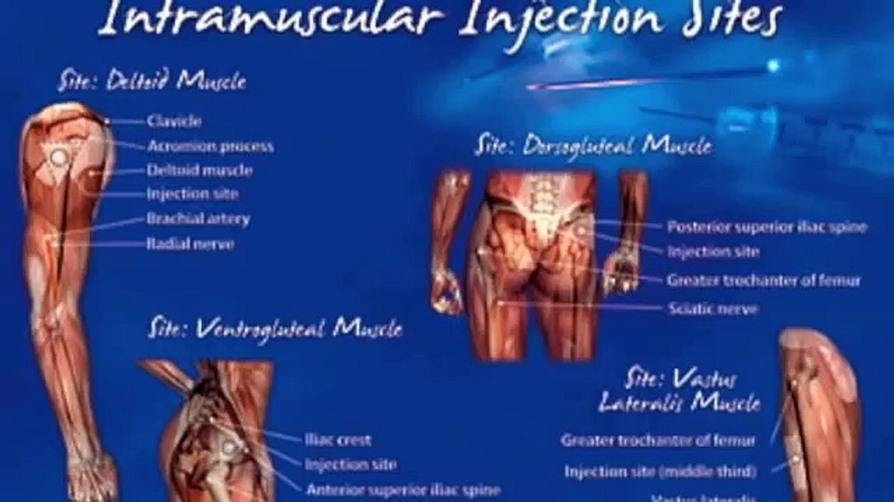 Intramuscular Testosterone Injection Techniques