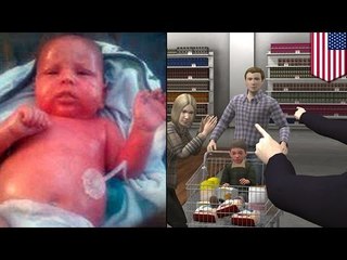 Érythrodermie Ichtyose: Des parents sont accusés de maltraitance d'enfant