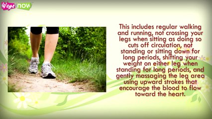 Treating Varicose Veins Naturally