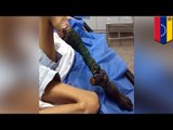 Noga dziewczyny ugryzionej przez węża strawiona przez jad