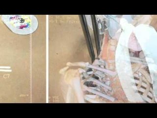 Batang lalake, nabangga ng scooter at nasaksak ng chopsticks sa leeg!