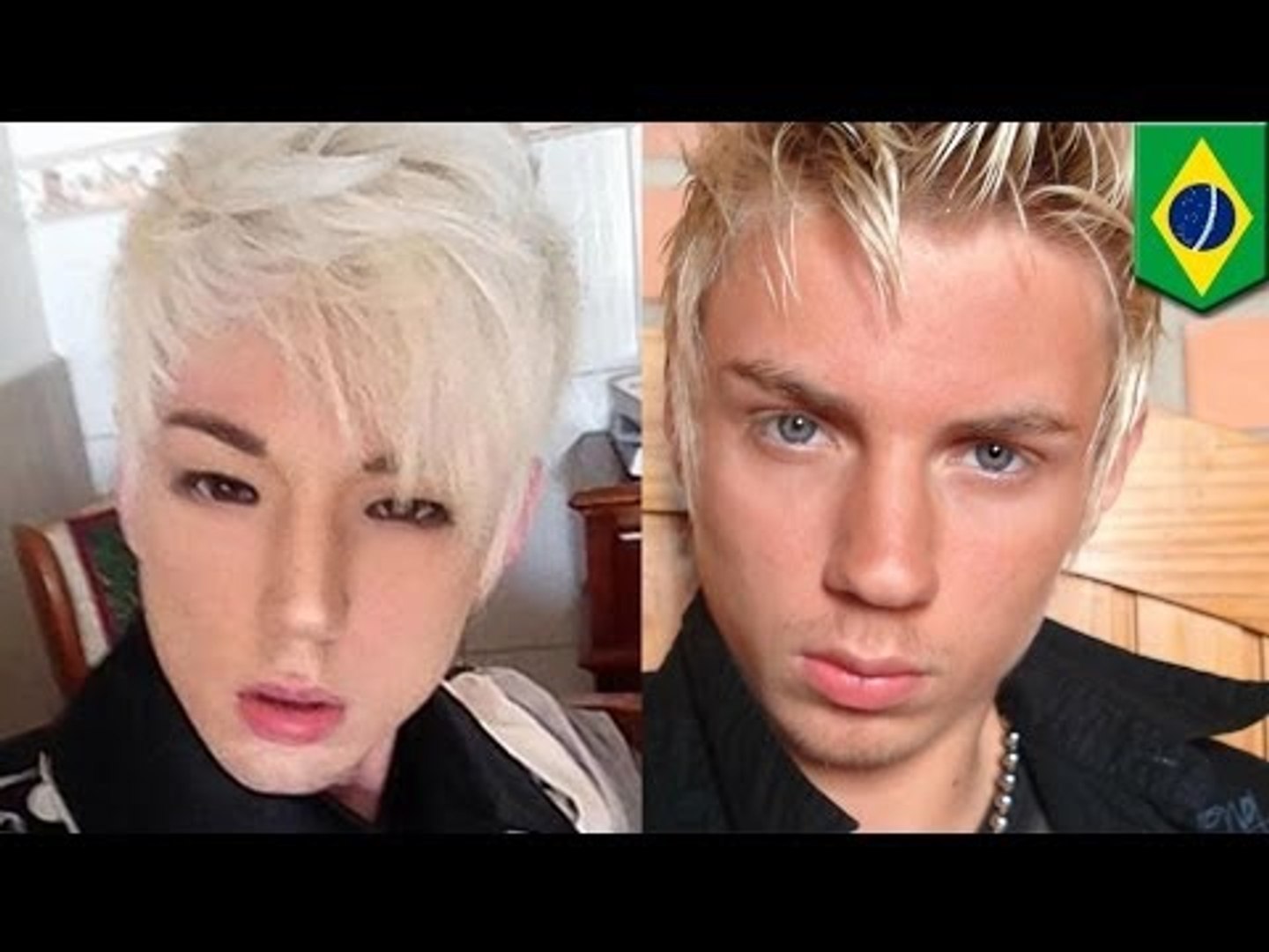 ⁣Plastic surgery gone wrong: Brazilian man Xiahn Nishi (니시샨) Korean plastic surgery for Asian eyes