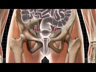 Steroids, literal na ginawang lalaki ang isang babae!