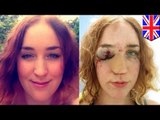 Kobieta zostaje uderzona w twarz przez obmacującego ją mężczyznę.