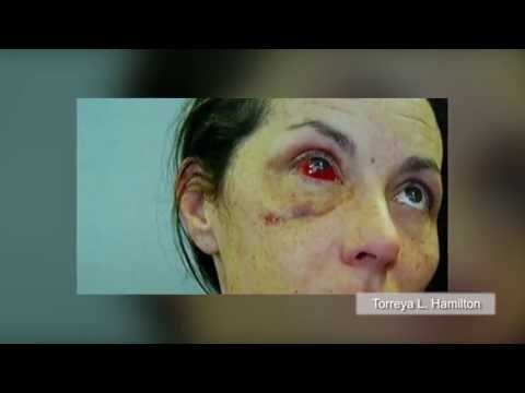 POLICE BRUTALITY: Babae, inasulto ng pulis, nabasag ang buto sa mukha (Actual Footage)