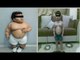 Obese toddler, before and after gastric bypass surgery (actual photos)